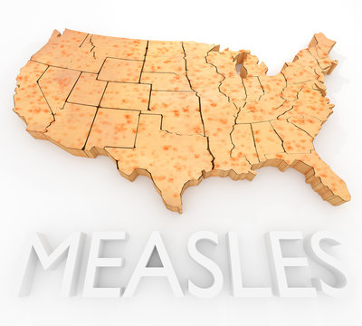 Measles Return To The US