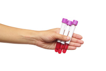 Hand  holding blood sample via.