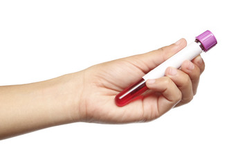 Hand  holding blood sample via.