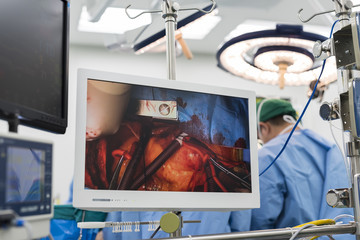 medical monitor