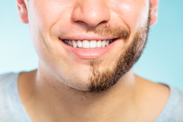 Fototapeta premium Happy man with half shaved face beard hair.
