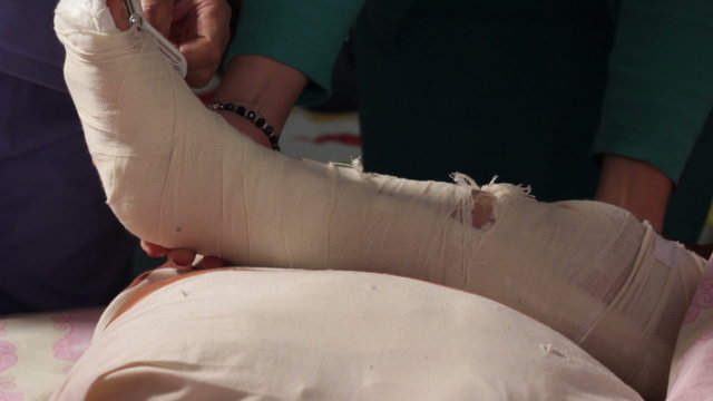 Medic technician moving plaster from bandaged broken leg of little child,cutting bandage with scissors,close up.