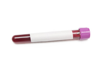 Blood Sample