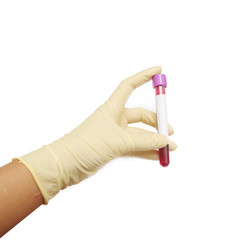 Hand holding blood sample via.