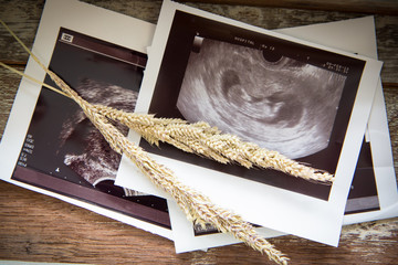 Memories of infant baby ultrasound Images in a vintage wooden bo
