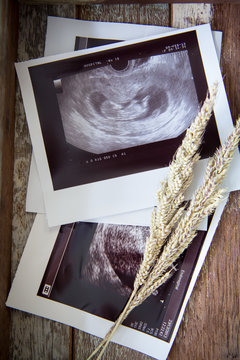 Memories of infant baby ultrasound Images in a vintage wooden bo
