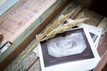 Memories of infant baby ultrasound Images in a vintage wooden bo