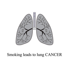Smoking leads to lung cancer. Vector illustration on isolated