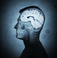 Conceptual image of a man from side profile showing brain and brain activity. Retro stale.