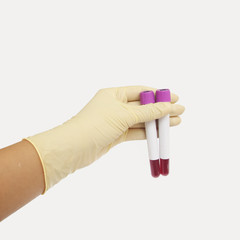 Hand  holding blood sample via.