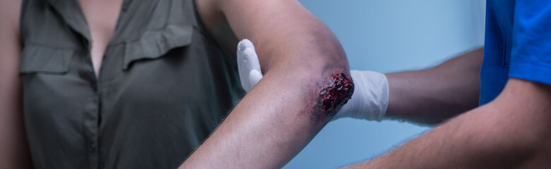 Professional medical help