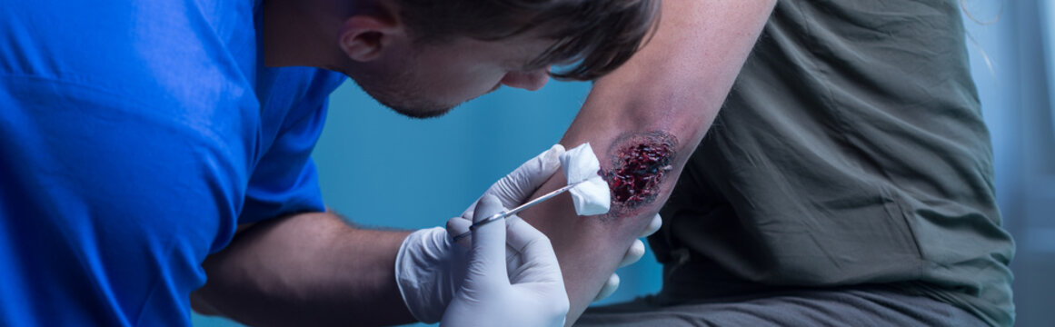 Surgeon Medicating Bloody Wound