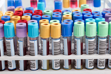 blood tubes in rack in the lab /blood tube test for analysis in the laboratory of haematology 