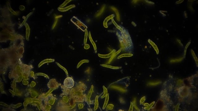 Mikroorganismus unter dem Mikroskop - 1080p Full HD