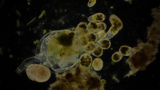 Mikroorganismen im Mikroskop - 1080p Full HD
