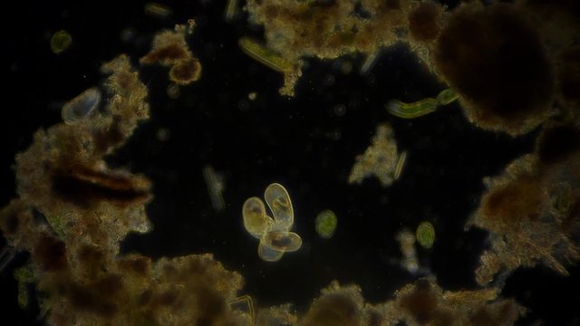 Phytoplankton unter dem Dunkelfeldmikroskop - 1080p Full HD