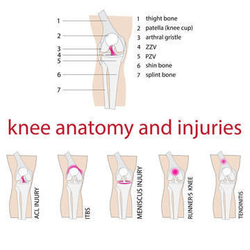 vector illustration of knee anatomy with description and injuries