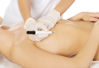 Young woman before breast surgery.