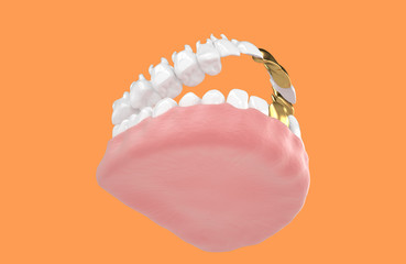 jaw64