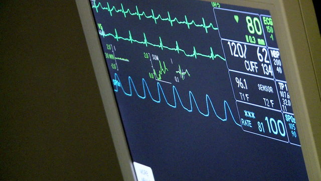 Vitals monitor during surgery