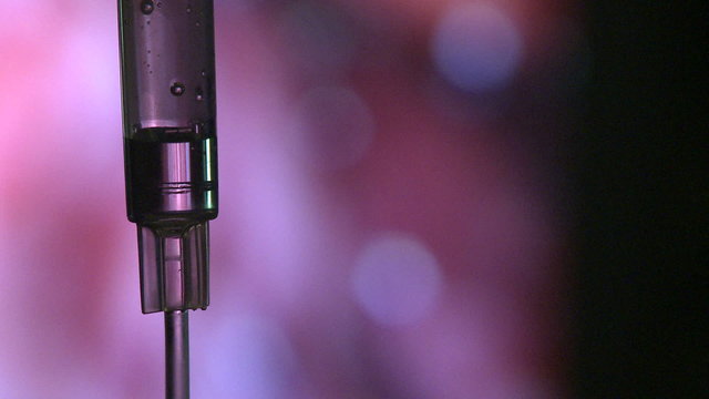 IV drip during laparoscopy