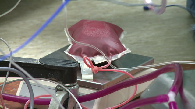 Robotic hysterectomy blood