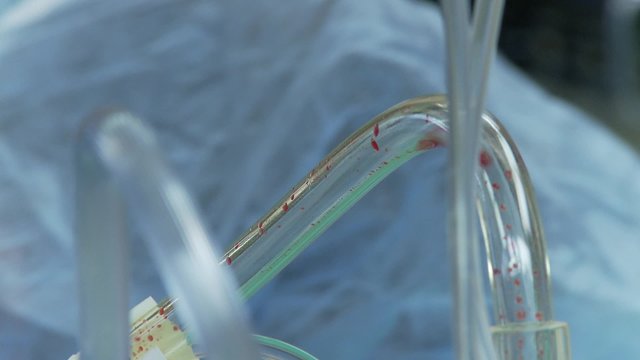 Spinal surgery blood