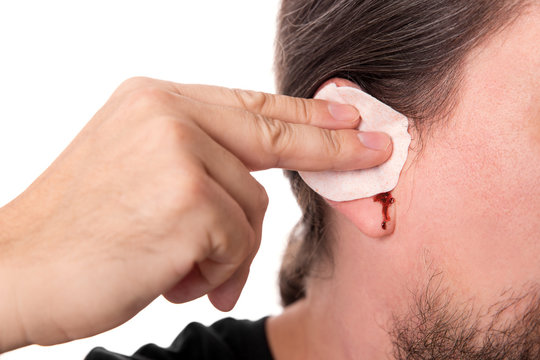 Mann blutet aus dem Ohr, Konzept Ohrenbluten und Verletzung