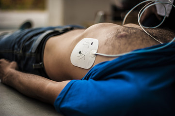 elettrodi defibrillatore - obrazy, fototapety, plakaty