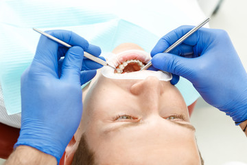 Dental checkup of the pacient