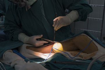 greater saphenous vein harvest for venous conduit