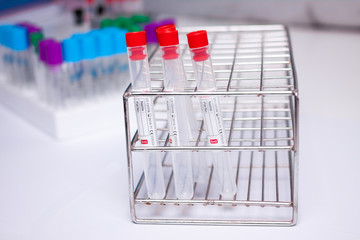 vaccum tube for testing in Lab