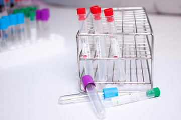 vaccum tube for testing in Lab