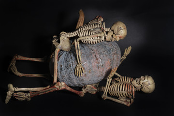 Pumpkin over skeleton