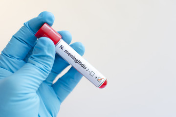 Obraz premium Blood sample with Neisseria meningitides positive