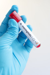 Obraz premium Blood sample with Neisseria meningitides positive