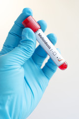 Obraz premium Melioidosis positive