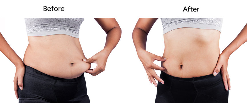 women body fat belly between before and after weight loss