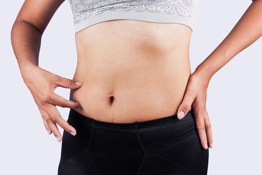woman pinching belly fat after weight loss,body slim