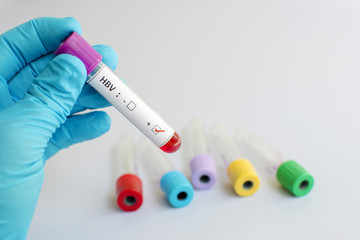 Fototapeta premium Hepatitis B virus (HBV)