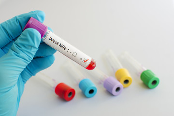 West Nile blood sample