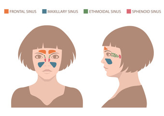 Obraz premium sinusitis disease, vector nose illustration, sinus anatomy, human respiratory system