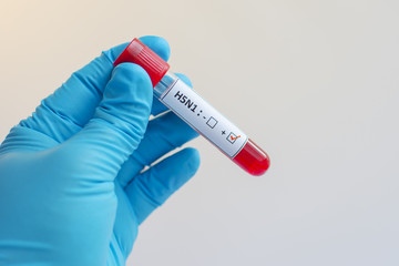 Fototapeta premium H5N1 influenza virus positive