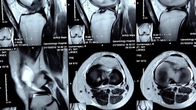 X-ray pictures in doctors office