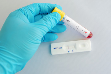 HIV testing positive