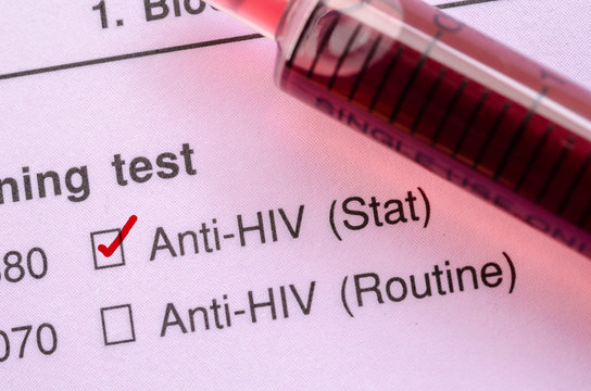 Red correct check mark with blood sample for HIV test.
