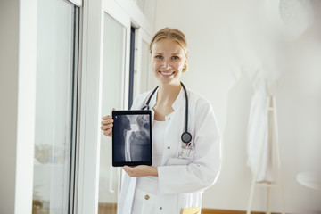 Portrait of smiling female doctor showing an x-ray on digital tablet