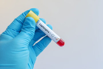 Obraz premium Leptospira blood sample