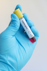 Obraz premium Leptospira blood sample