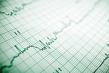 Electrocardiogram